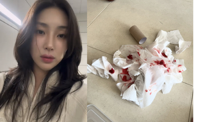 Giant Pink Reveals Bloody Tissue Photo..Please help me