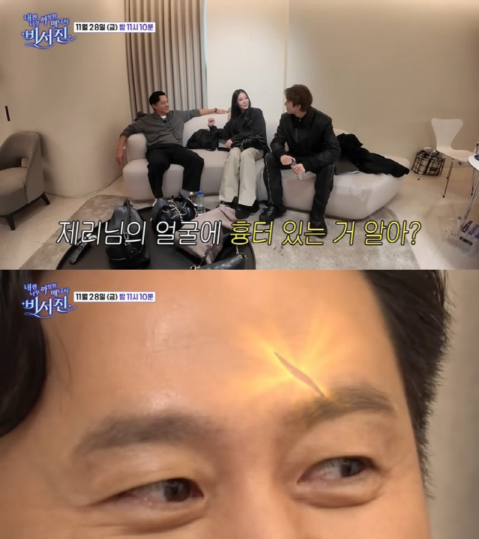 Lee Seojin forehead scar, only Shinsegae Annie knew...'The wound at my house'