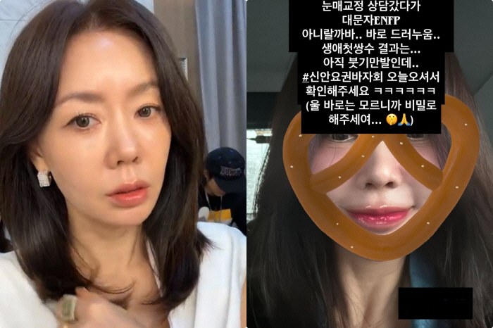 49-year-old Ahn Sun-young, serious swelling after double eyelid surgery..Hats and glasses to defend against the ironclad