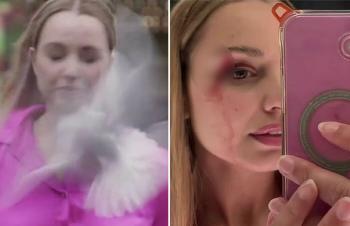 Seagull crash on the face of a live TV reporter, blood dripping...It looks like you need glasses