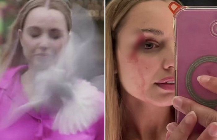 Seagull crash on the face of a live TV reporter, blood dripping...It looks like you need glasses