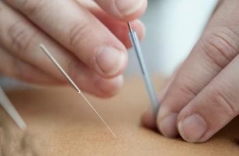 The reason for acupuncture on the other side of the sore spot, scientific evidence has emerged